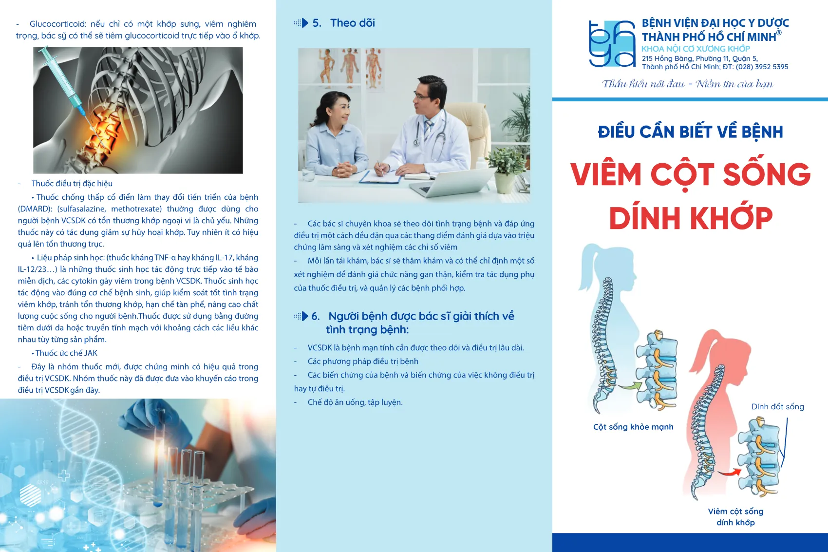 to roi dieu can biet ve benh viem cot song dinh khop_1.webp