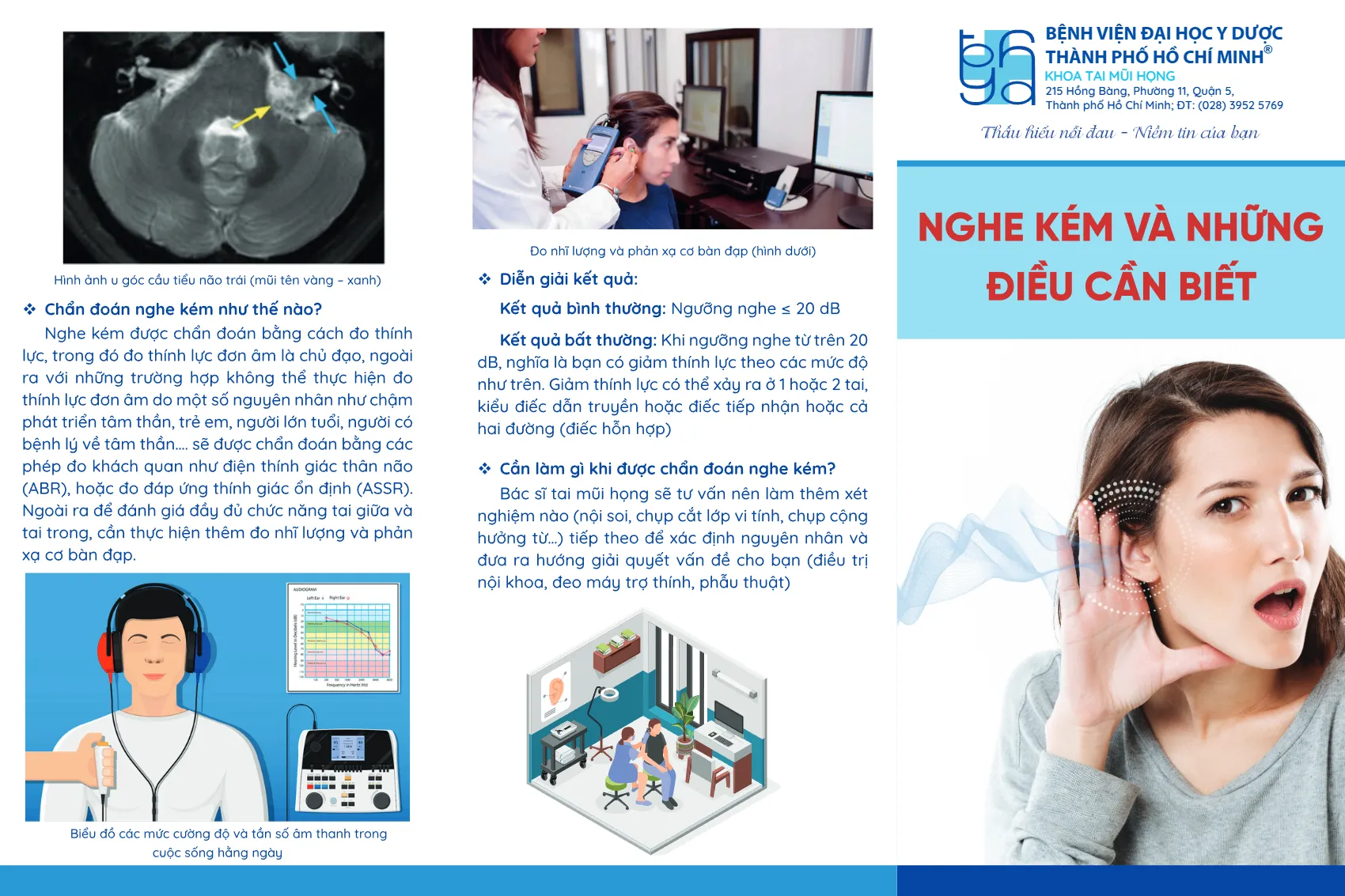 to roi nghe kem va nhung dieu can biet_1