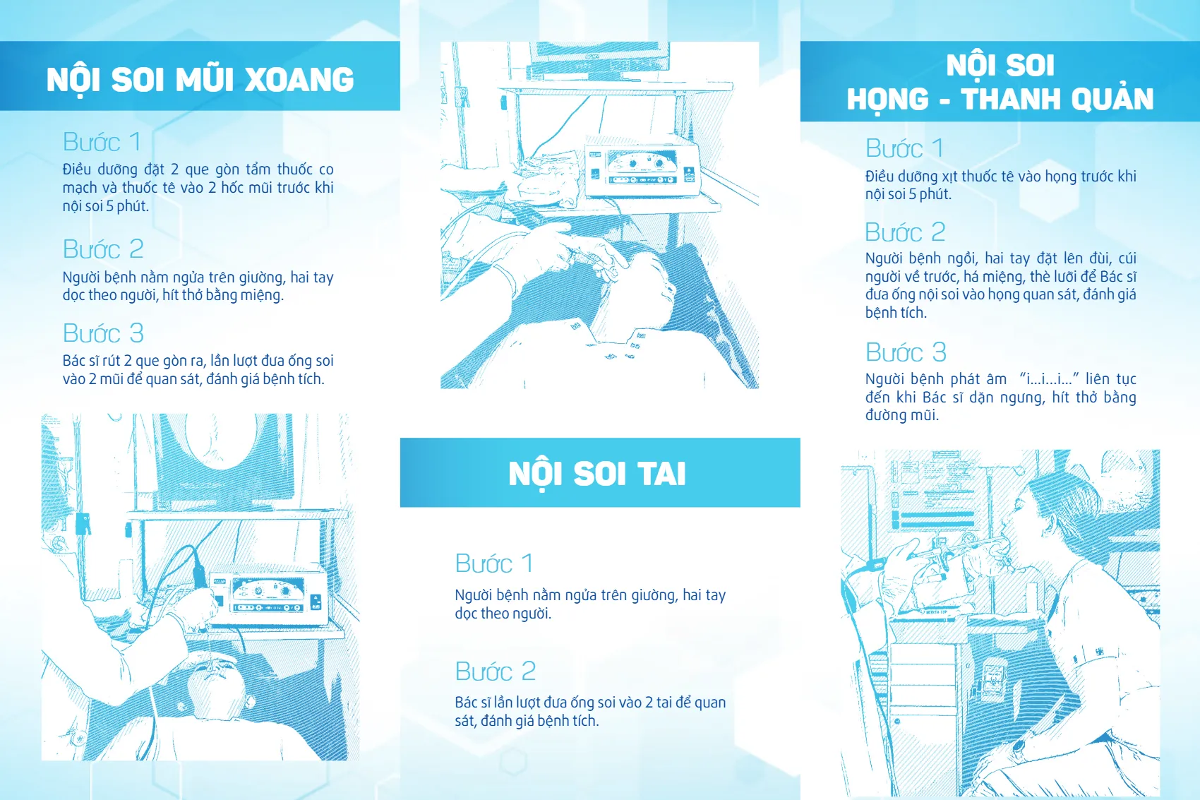to roi nhung dieu nguoi benh can biet truoc khi noi soi tai mui hong_2