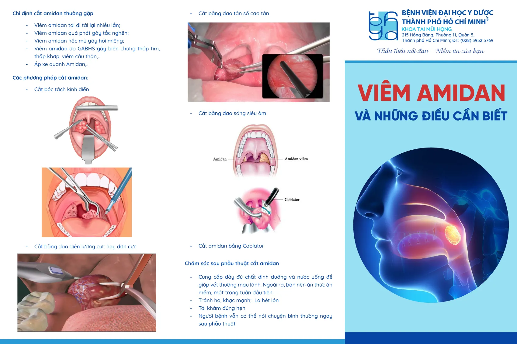 to roi viem amidan va nhung dieu can biet_1