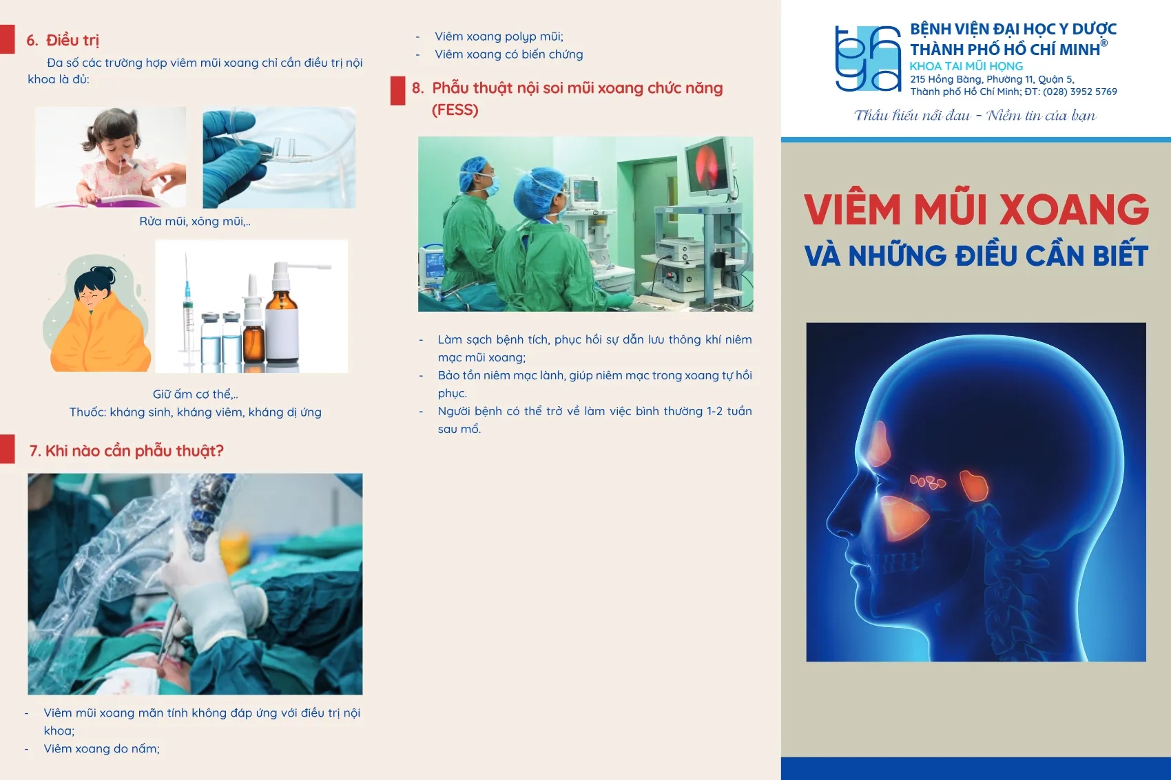to roi viem mui xoang va nhung dieu can biet_1