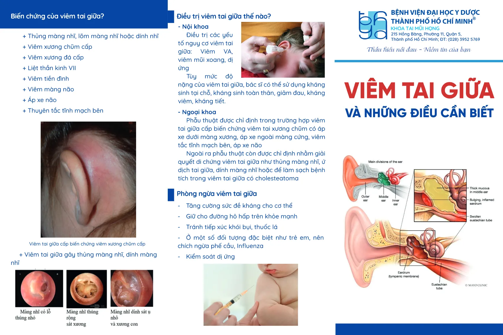 to roi viem tai giua va nhung dieu can biet_1